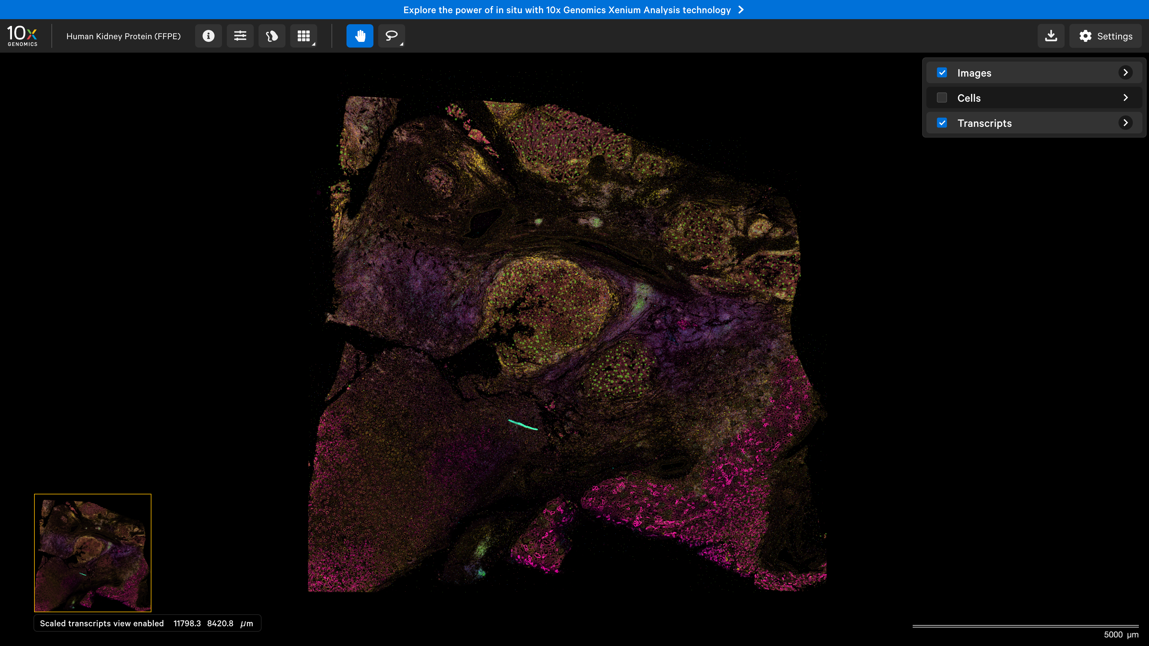 Welcome! Today, we're diving into this human kidney sample to showcase the power of RNA and protein integration in a single Xenium output. Let's begin!